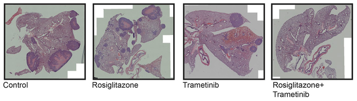 Рис. 3. Гистологические срезы мышиных легких через 4 месяца после ксенотрансплантации