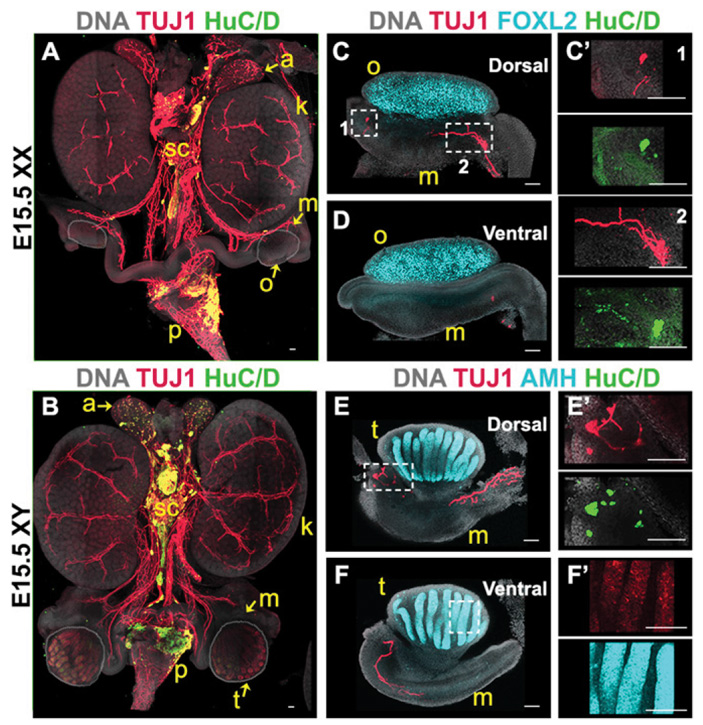 Рис. 2. Распределение нейрональных маркеров