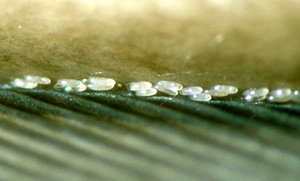 Рис. 2. Яйца перьевого клеща из рода Scutomegninia на перьях баклана