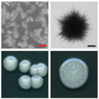 Колонии разных штаммов гриба Candida albicans