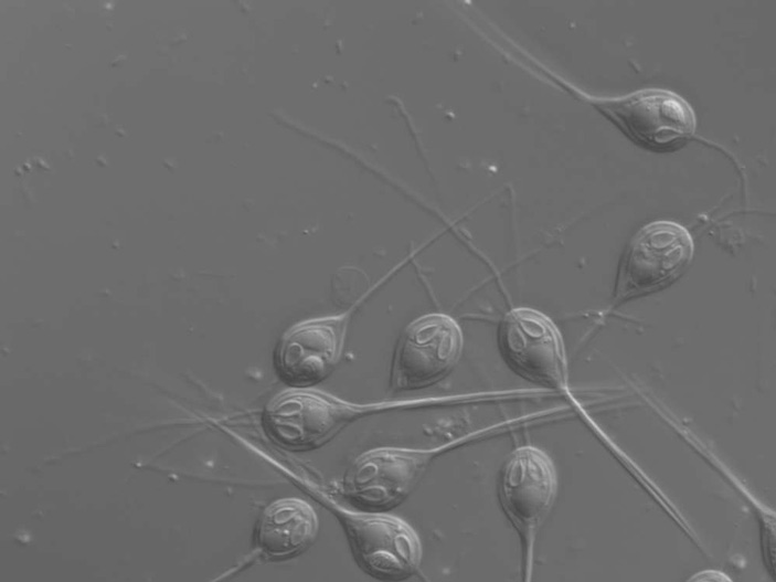 Многоклеточные споры эннегии (Henneguya salmonicola)