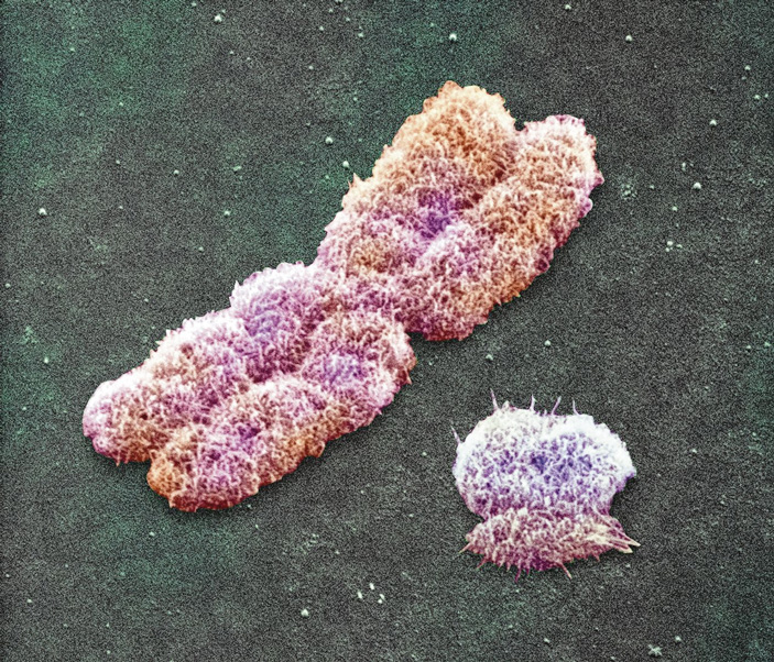 Микрофотография половых хромосом человека