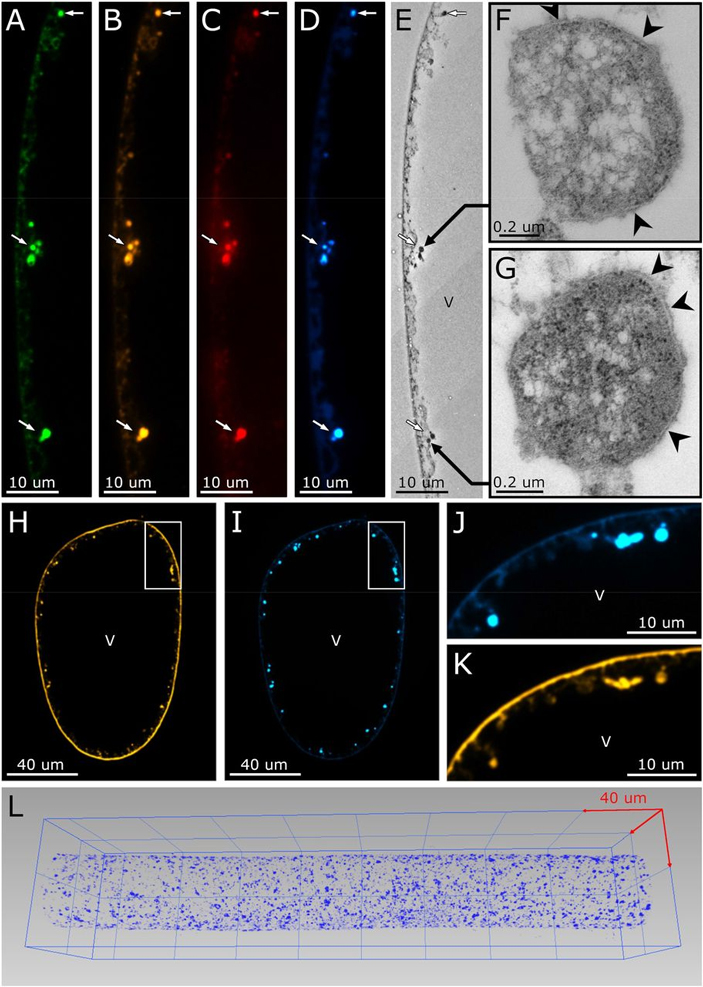 Рис. 4. Результаты дополнительных исследований, проведенных для уточнения тонкой структуры бактерий Thiomargarita magnifica
