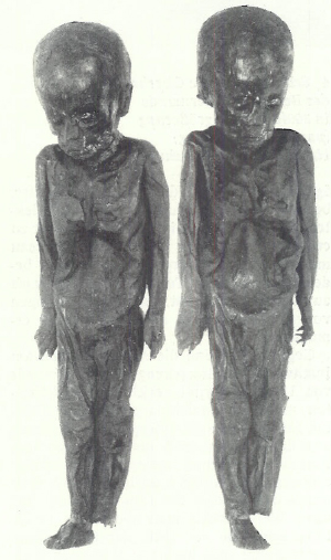 Мумия египетского мальчика, одна из 23 мумий, из которых Сванте Пэабо брал гистологические срезы для окрашивания на присутствие ядер и ДНК