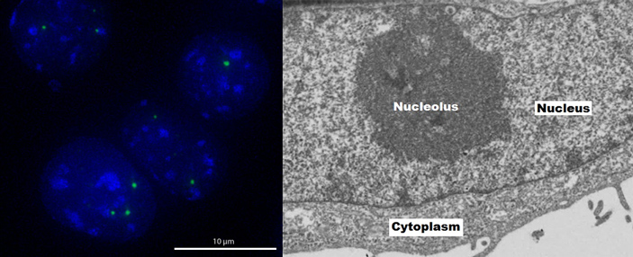 Рис. 3. Тельца Кахаля в ядре клетки