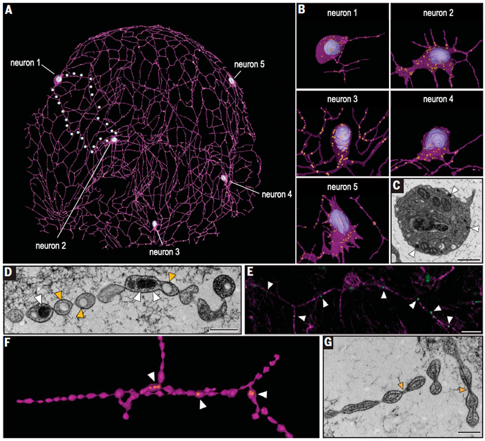 Рис. 2. Ультраструктура субэпителиальной нервной сети гребневика