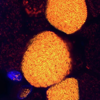 Рис. 1. Тканевое распределение бактерий ‘Ca. Endonucleobacter’