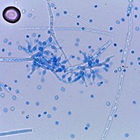 Tolypocladium inflatum