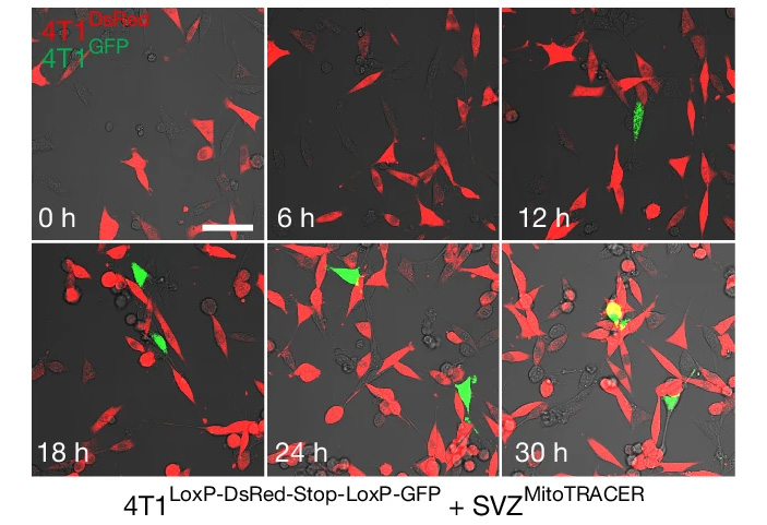 Рис. 3. Конфокальная микроскопия совместной культуры нейронов SVZ и клеток 4T1