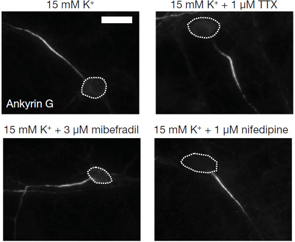 При «выключении» двух типов кальциевых каналов с помощью специфических блокаторов (мидефрадила и нифедипина) ИСА перестает сдвигаться. В то же время «выключение» натриевых каналов с помощью блокатора тетродотоксина (ТТХ) не влияет на передвижения ИСА. Изображение из обсуждаемой статьи в Nature