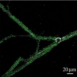 Клетки бактерий Pseudomonas putida на грибных гифах