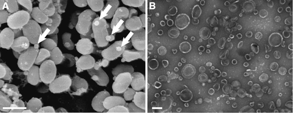 Прохлорококки производят мембранные пузырьки