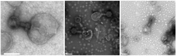 Фаги, «заражающие» мембранные пузырьки