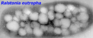 Ralstonia eutropha