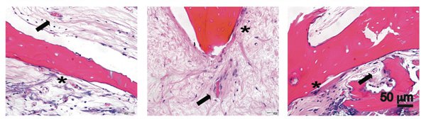 Рис. 2.Микрофотографии косточек после двенадцати недель имплантации