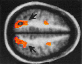 Области мозга, связанные с визуальной памятью (рис. с сайта www.colorado.edu)