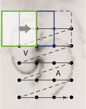 Рис. 1. Схема освещения сердца маленькими перекрывающимися участками. A — atrium, предсердие, V — ventricle, желудочек. Рис. из обсуждаемой статьи в Science