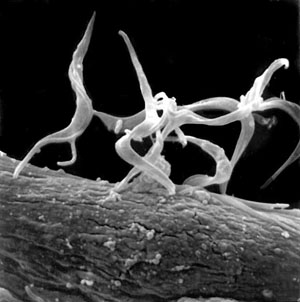 Неизлечимая болезнь Шагаса, вызываемая паразитом T. cruzi (на фото), может заканчиваться инвалидностью и даже смертью (фото с сайта www.fiocruz.br)