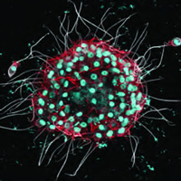 Колониальные хоанофлагелляты B. monosierra из озера Моно