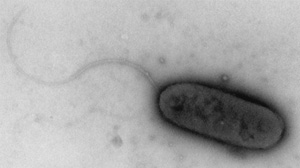 Бактерия Azoarcus, в геноме которой есть самовырезающиеся интроны группы I. Фото из статьи van Schie, Young, 1998