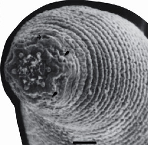 Портрет Halicephalobus mephisto (анфас, три четверти), одного из четырех видов нематод — обитателей глубинных биосфер. Это первые из многоклеточных животных, найденные в глубоких слоях осадка. Фото из обсуждаемой статьи в Nature