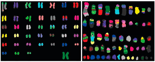 Метафазные хромосомы нормальной собаки и ТВС