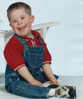 Сегодня в мире каждый шестисотый ребенок рождается с синдромом Дауна (фото с сайта www.einstein-syndrome.com)