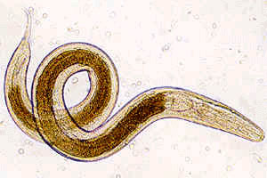 Острица (Enterobius vermicularis), по-видимому, не только вызывает у человека энтеробиоз, но и защищает его от гораздо более опасного заболевания — рассеянного склероза (изображение с сайта www.medtrust.ru)