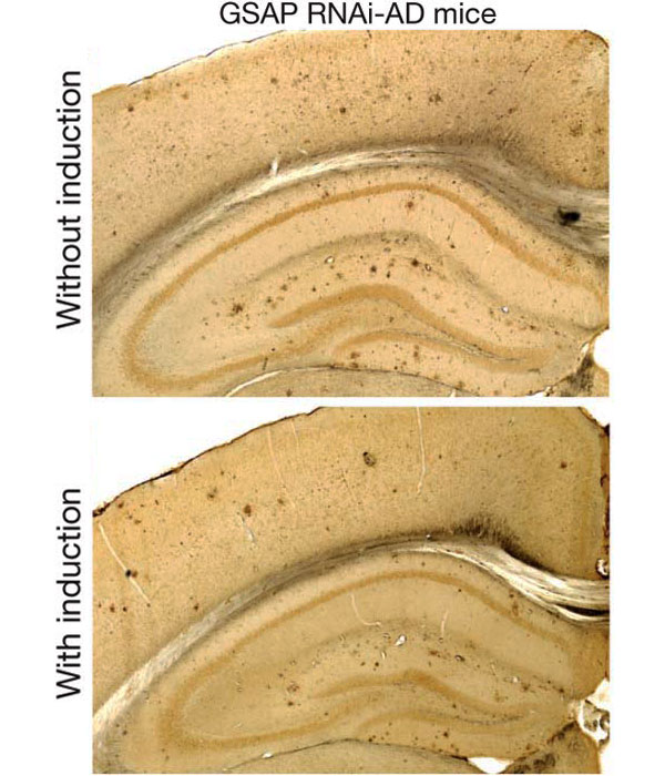 Количество бляшек в мозге экспериментальных мышей уменьшается после выключения GSAP. Изображение из обсуждаемой статьи в Nature