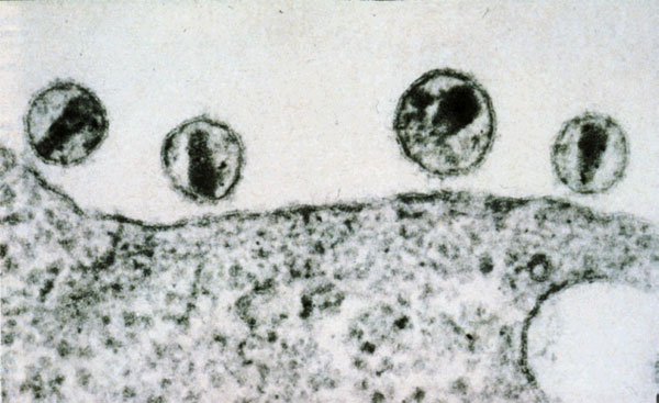 Электронная микрофотография вирусов иммунодефицита человека (ВИЧ). Открытие этих вирусов, вызывающих синдром приобретенного иммунодефицита (СПИД), позволило выработать меры по предотвращению и лечению этой болезни. Хотя вакцину против ВИЧ еще не удалось разработать, современные методы, пока довольно дорогостоящие, позволяют бороться с симптомами ВИЧ-инфекции и продлевать жизнь больным на многие десятилетия. (К сожалению, не удалось разработать методов, которые позволили бы полностью очищать зараженный организм от ВИЧ.) Изображение, полученное Мартином Хартманном (Dr. Martin Hartmann) из Гейдельбергского университета, с сайта www.tolzin.de