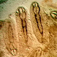 Метацеркарии трематоды D. pseudospathaceum