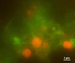 Загадочный консорциум бактерий. Архебактерии, объединенные в кластеры, окрашены в красный цвет, неизвестные эубактерии — в зеленый (фото с сайта noorderlicht.vpro.nl)