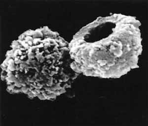 Нанобактерия строит вокруг себя кальций-фосфатный панцирь (фото с сайта www.wired.com)