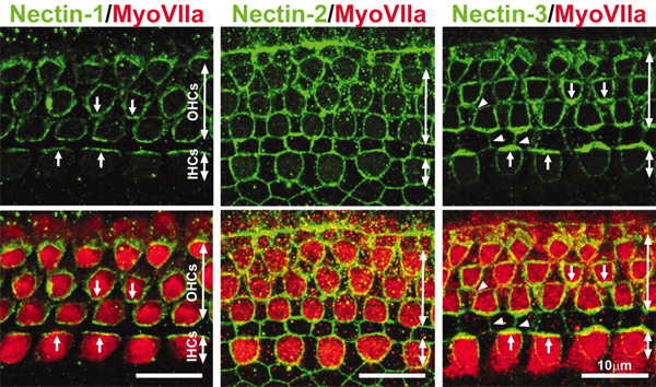 Вот где встречаются нектины разных типов в слуховом эпителии новорожденных мышат. Изображение из обсуждаемой статьи в Science