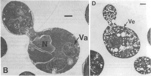 Электронные микрофотографии дрожжевых клеток, растущих при нормальной температуре и при температуре активации мутаций