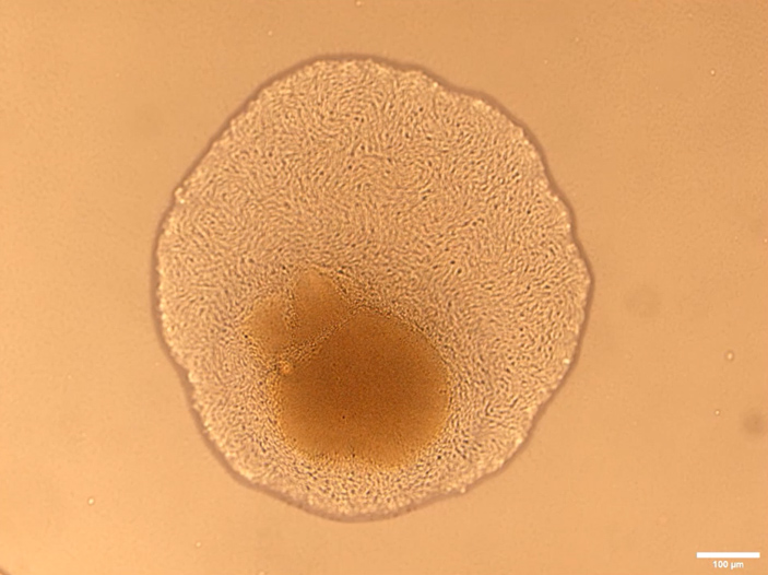 Рис. 1. Колония бактерий Jeongeupia sacculi