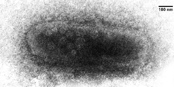 Трансмиссионная электронная фотография, показывающая бактерию, зараженную вирусами. Вирусные частицы хорошо видны внутри клетки. Бактерия извлечена из поверхностных донных отложений на большой глубине. Масштабная линейка 100 нм. Фото из приложения к обсуждаемой статье в Nature