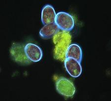 Prorocentrum lima — мелкие морские водоросли (динофлагелляты) окрашенные флуоресцентными красителями. У них два жгутика, которые на этом снимке не видны. Фото с сайта www.fiu.edu