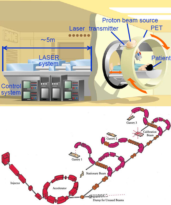 Вверху: схема установки для протонной терапии с помощью лазерного ускорения. Внизу: для сравнения приведена схема центра протонной терапии с обычным ускорителем (изображения из статьи arXiv:0804.3826 и с сайта www.proton-therapy.org)<