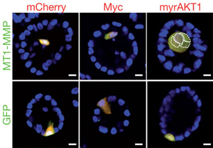 Опухоль развивается, когда клетки экспрессируют и myrAKT1. и MT1-MMP