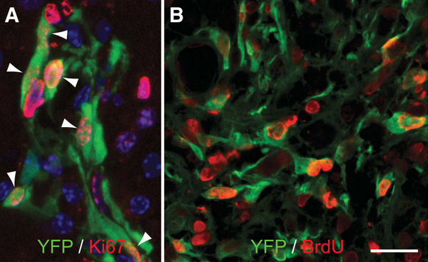 Рис. 4. Перициты типа А в участке травмы показывают бурную пролиферацию. Изображение из обсуждаемой статьи в Science