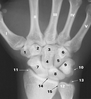 Кости запястья, из которых у хоббита (LB1) сохранилось три: scaphoid (ладьевидная, 7), 2 — trapezoid (трапециевидная, 2), 3 — capitate (головчатая, 3). Изображение с сайта www.szote.u-szeged.hu