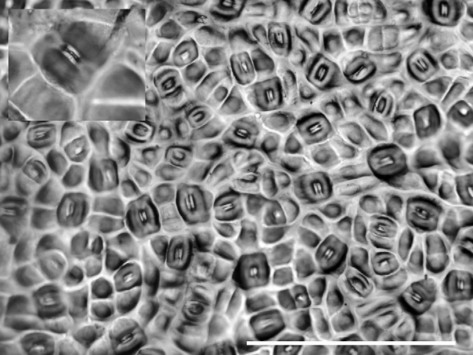 Рис. 1. Устьица на поверхности листа омелы