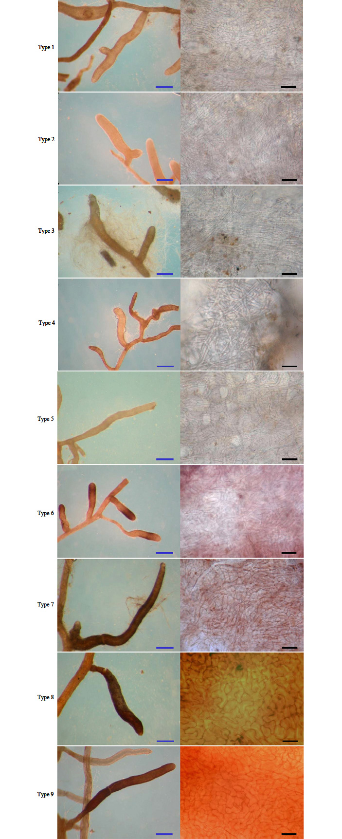 Рис. 5. Пример девяти типов микоризных корней (слева), найденных у тополя и ивы, растущих на Хоккайдо в нарушенных из-за извержения вулкана местообитаниях, и их поверхность (справа)