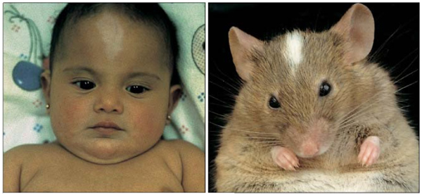 Рис. 4. Мутации гена kit у мыши и человека вызывают похожие изменения окраски