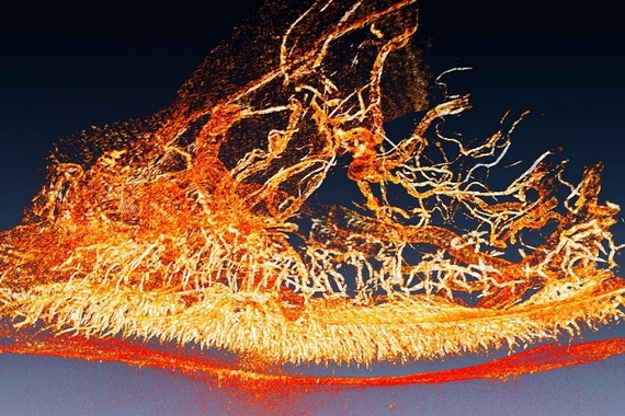 Трахеи лантерна