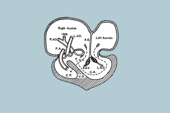 Сердце черепахи Коула