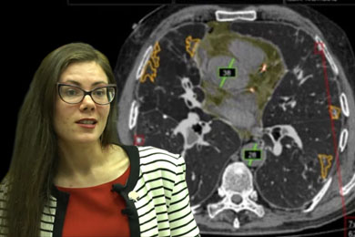 Искусственный интеллект в медицине